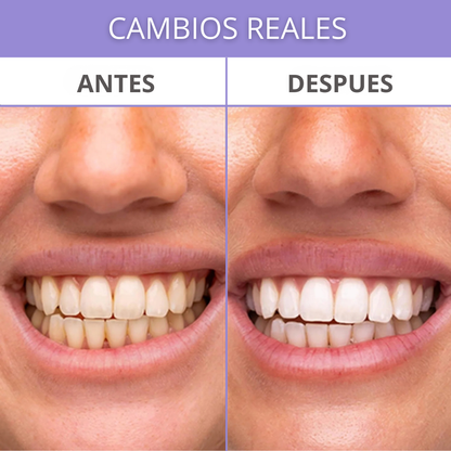 SmileUP Pro Blanqueador de dientes