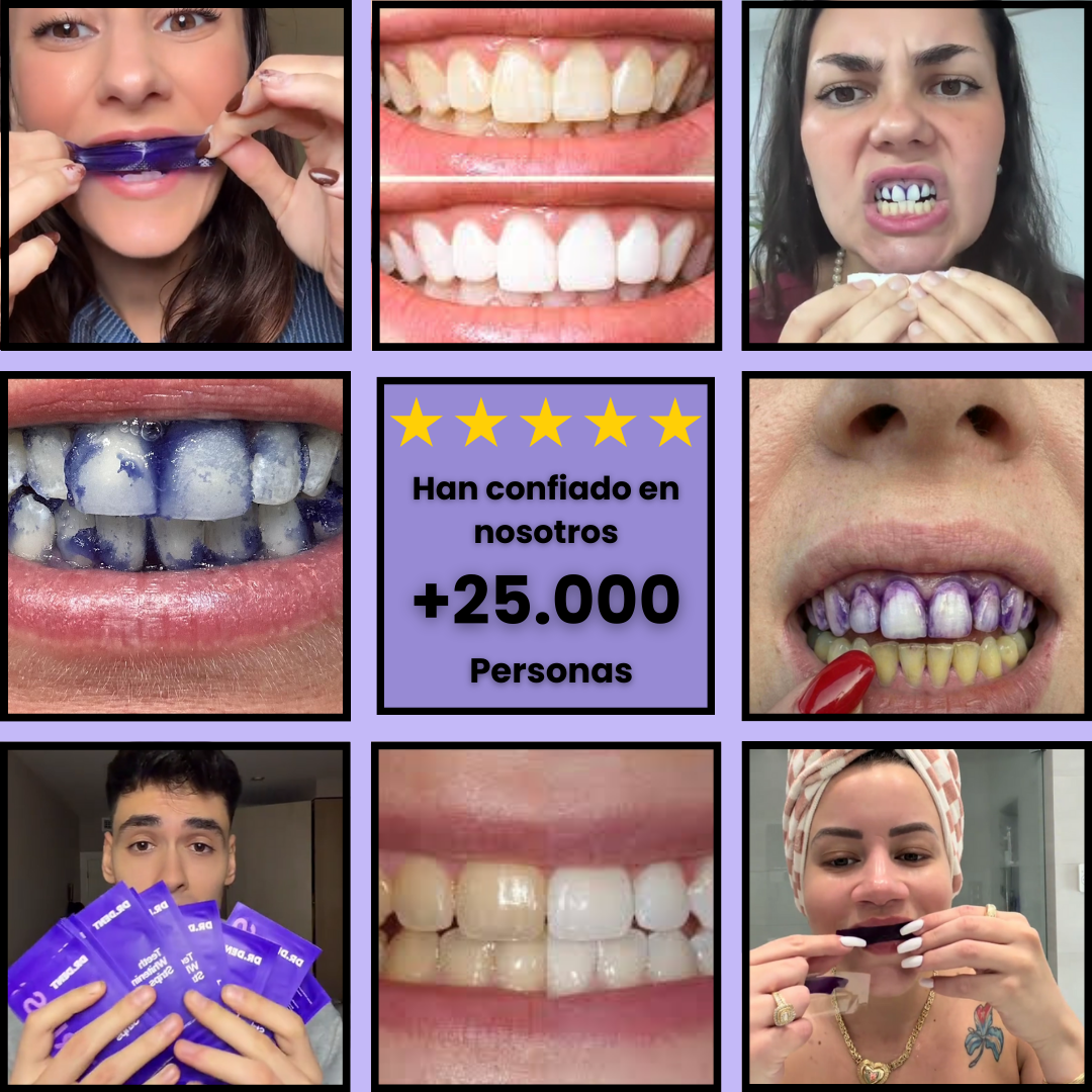 SmileUP Pro Blanqueador de dientes