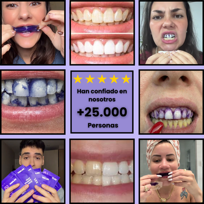 SmileUP Pro Blanqueador de dientes